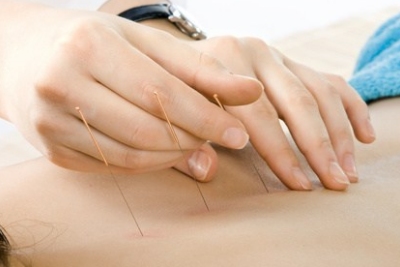 acupuncture Portsmouth physiotherapist Portsmouth